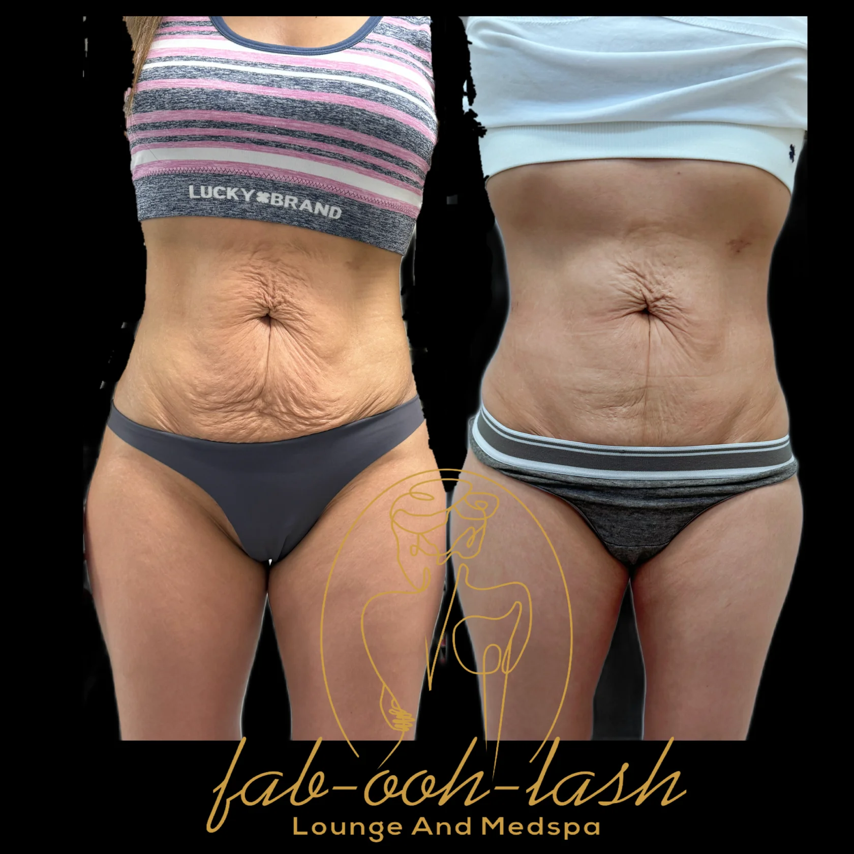 Skin Care Clinic Orting